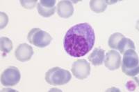 Plasmocyte x800